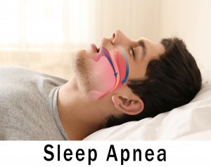 διαβήτης και υπνική άπνοια