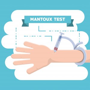 δερμοαντίδραση Mantoux